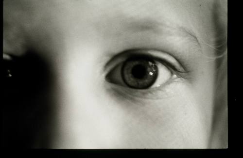 Alex's Eye