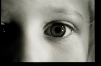 Alex's Eye